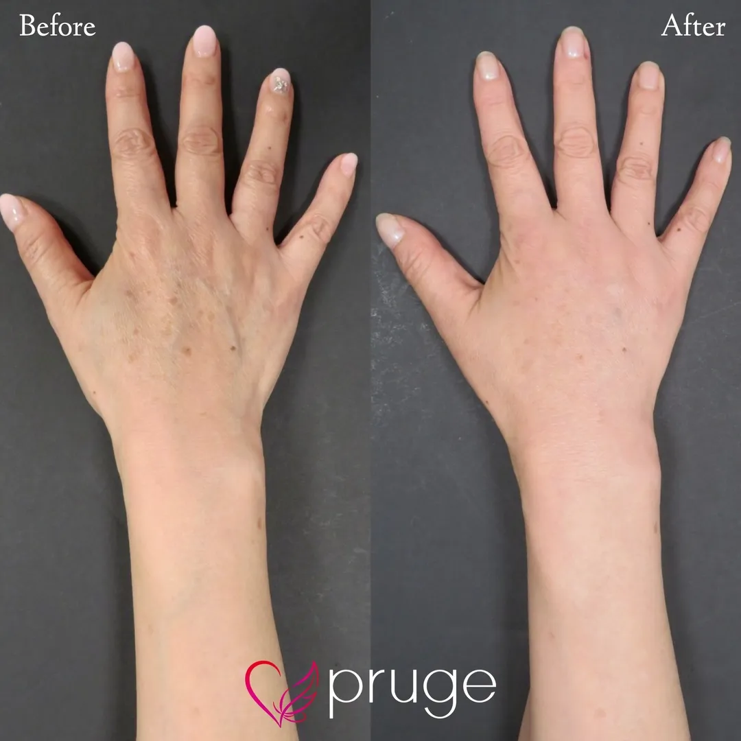 手の乾燥・くすみ