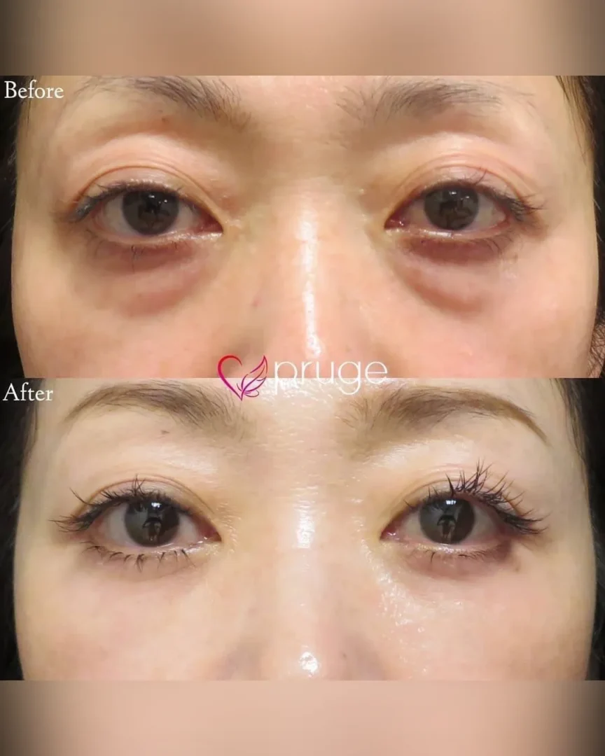 岡本 慎一理事長 代表症例6