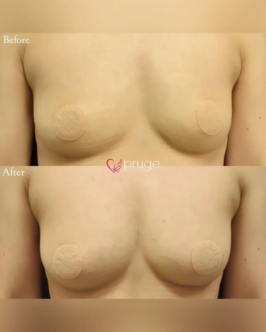 塩見 知大院長 代表症例6