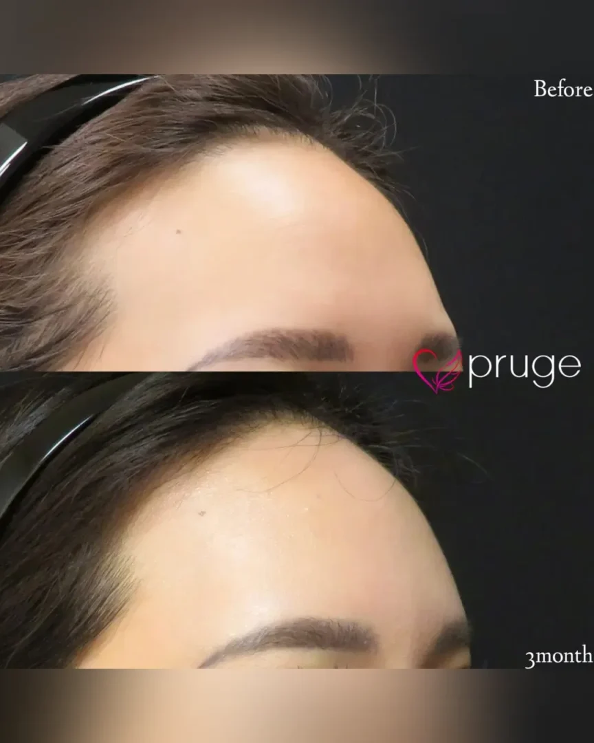 岡本 慎一理事長 代表症例4