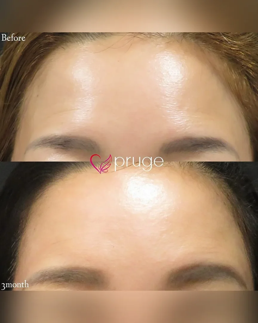 塩見 知大院長 代表症例3