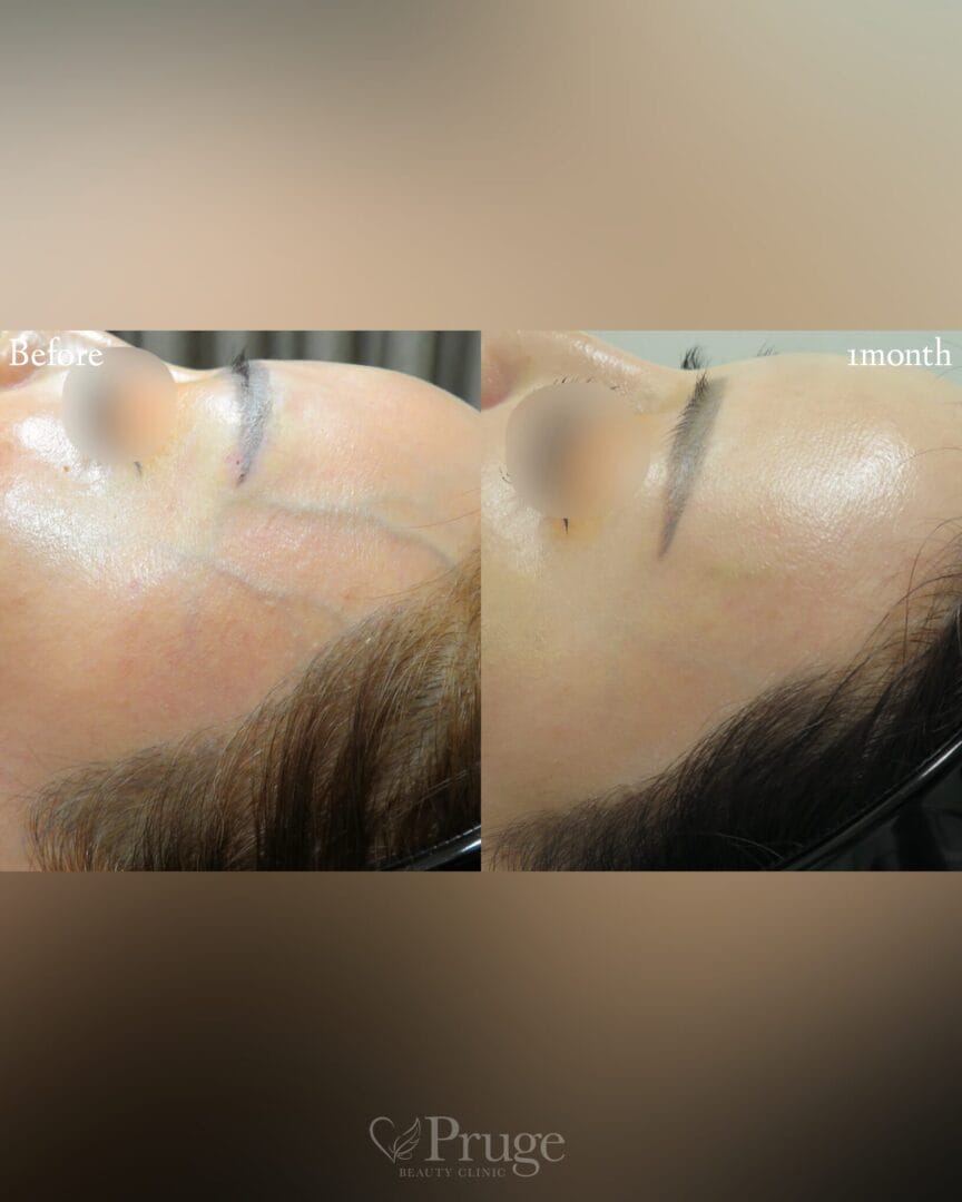 岡本 慎一理事長 代表症例3