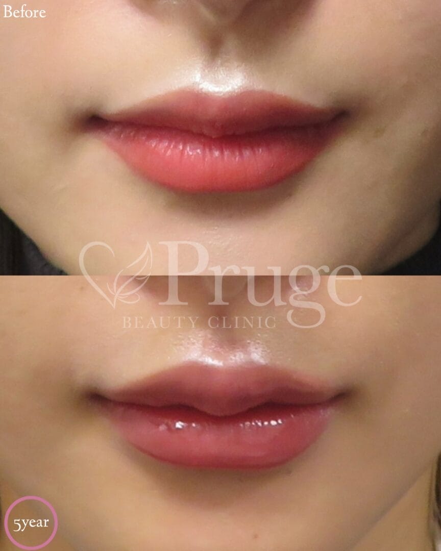 岡本 慎一理事長 代表症例1