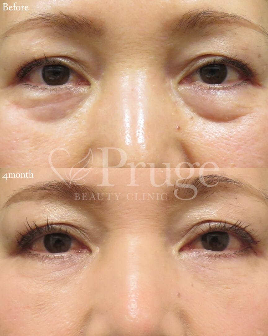 塩見 知大院長 代表症例1