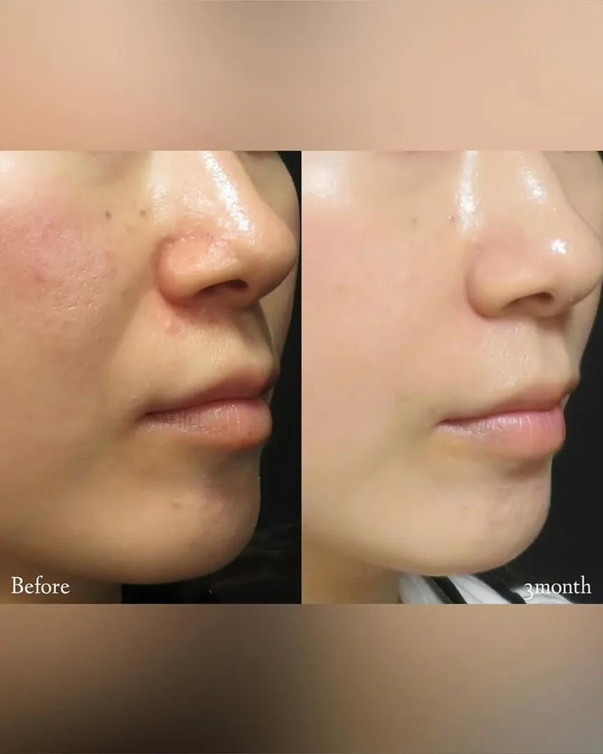 塩見 知大院長 代表症例5