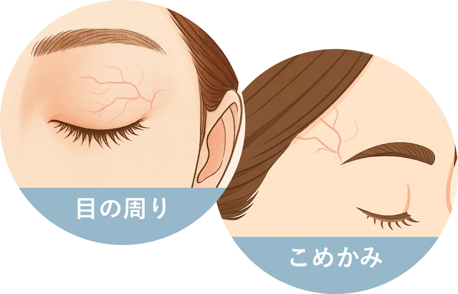 目の周り・こめかみ