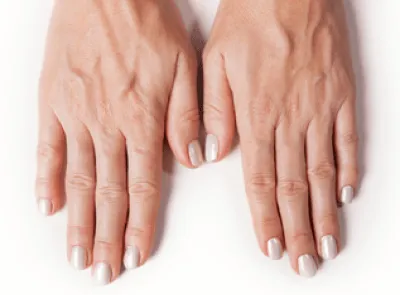 ハンドベインとは？