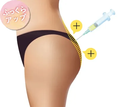 PRP注射/理想のボディライン形成