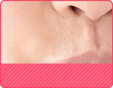 上唇と鼻の間のシワ