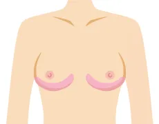 アンダーバストのボリュームアップ