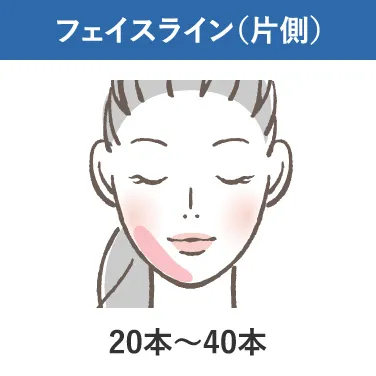 フェイスライン(片側)