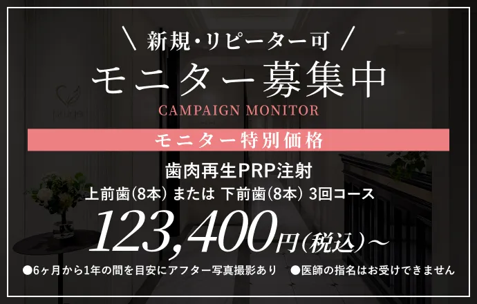 モニター募集中