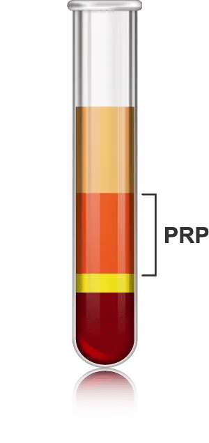 PRP