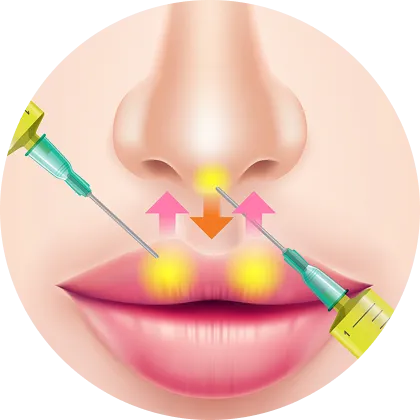 PRP注射注入部位