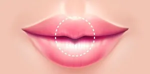 リプポイントアップ