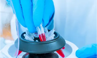 成長因子の抽出