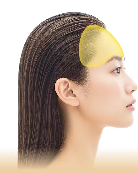 PRP注射だからできる重要なポイント