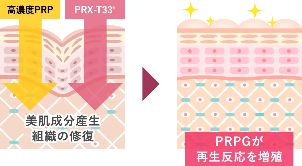 PRPマッサージピールのメカニズム