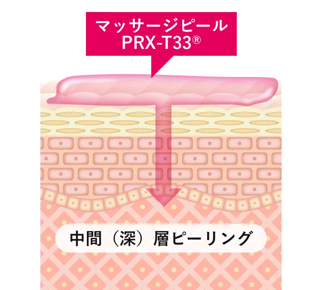 ●皮膚を剥離しないで古い角質を除去●表皮ターンオーバーの促進●強力美白