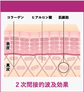 2次間接的波及効果