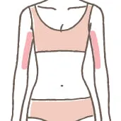 二の腕（両側）の施術イメージ