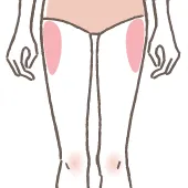 外もも＜大転子＞（両側）の施術イメージ