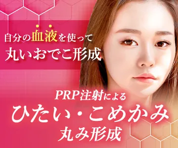 自分の血液を使って丸いおでこ形成　PRP注射によるひたい・こめかみ丸み形成