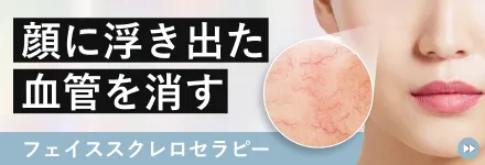 フェイススクレロセラピー